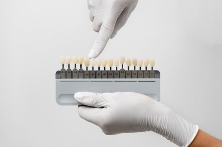 Do Dental Veneers Hurt? Debunking Common Misconceptions