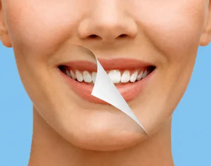 Teeth Whitening in Grimsby for Sensitive Teeth 